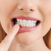 Zahnfleischrückgang - die wesentlichen Ursachen und Symptome