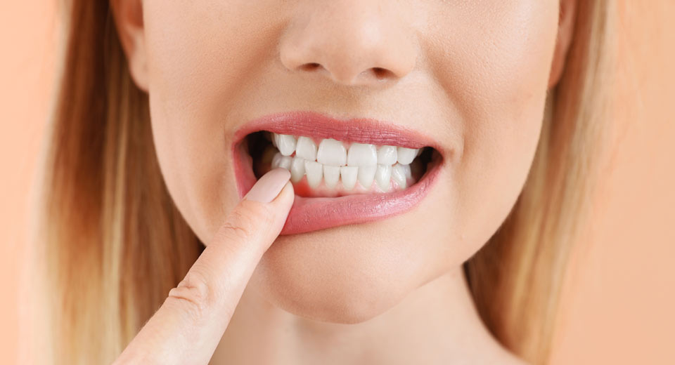 Zahnfleischrückgang - die wesentlichen Ursachen und Symptome